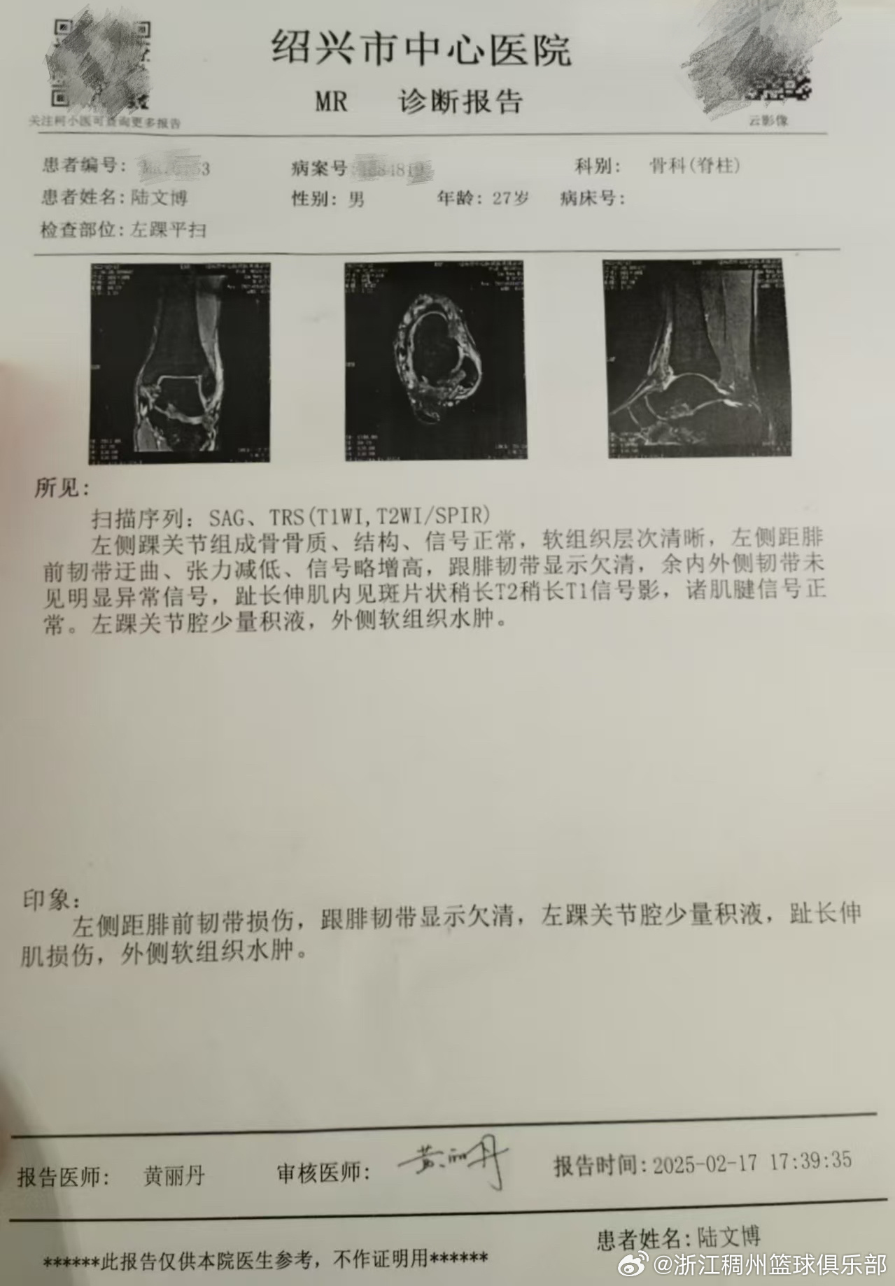 成为焦点人